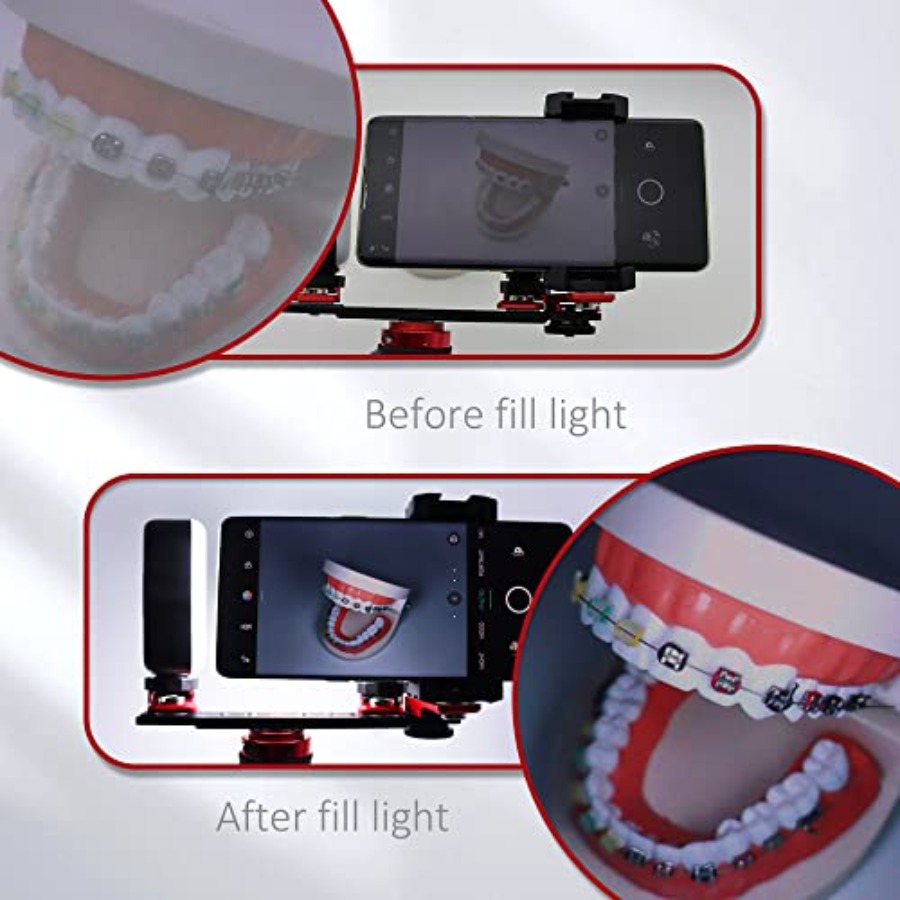 Bluetooth Dental Flash Light P - Photography Lighting With Flash ulasan dan harga