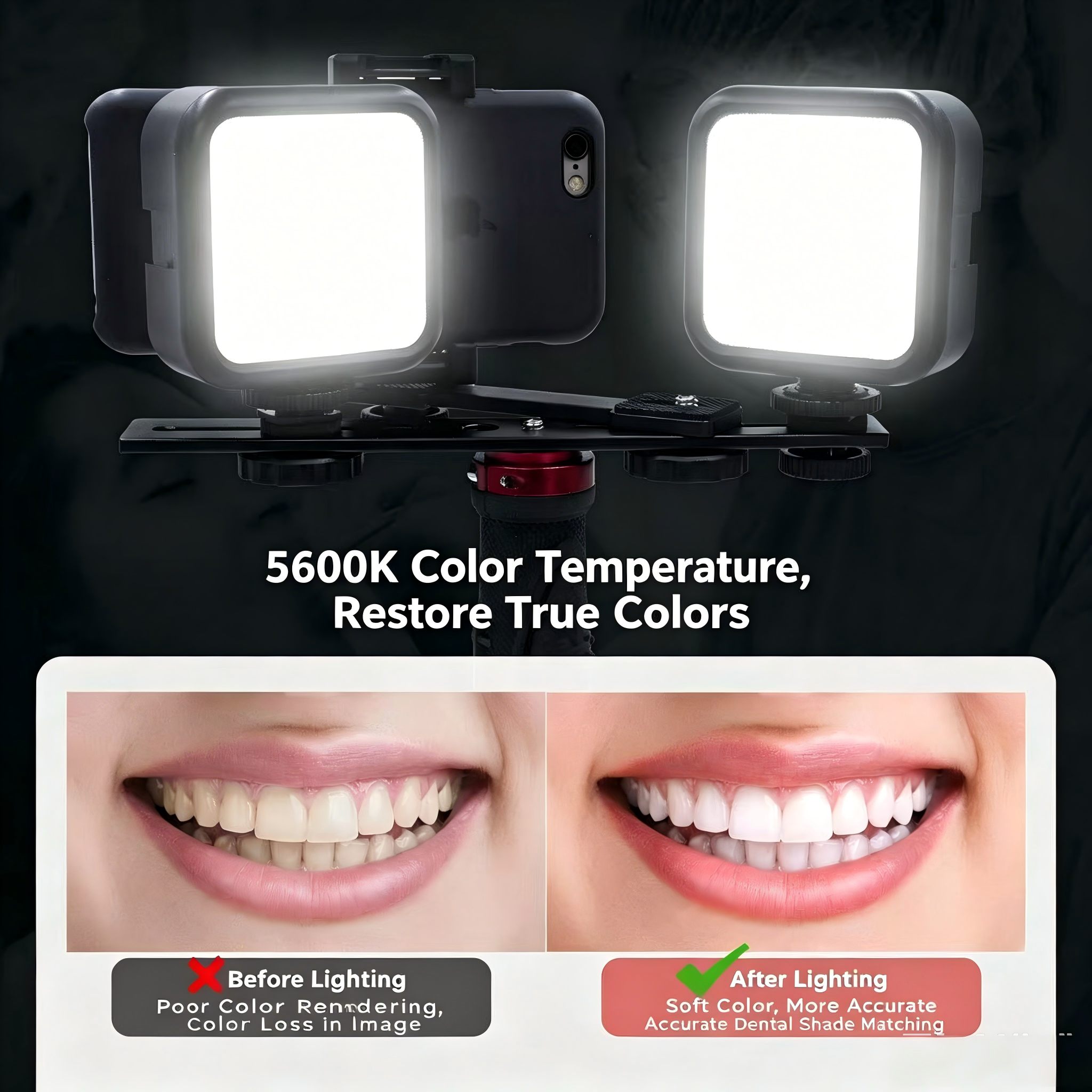 Portable Dental Photography Li - Photography Lighting Kit Portable ulasan dan harga