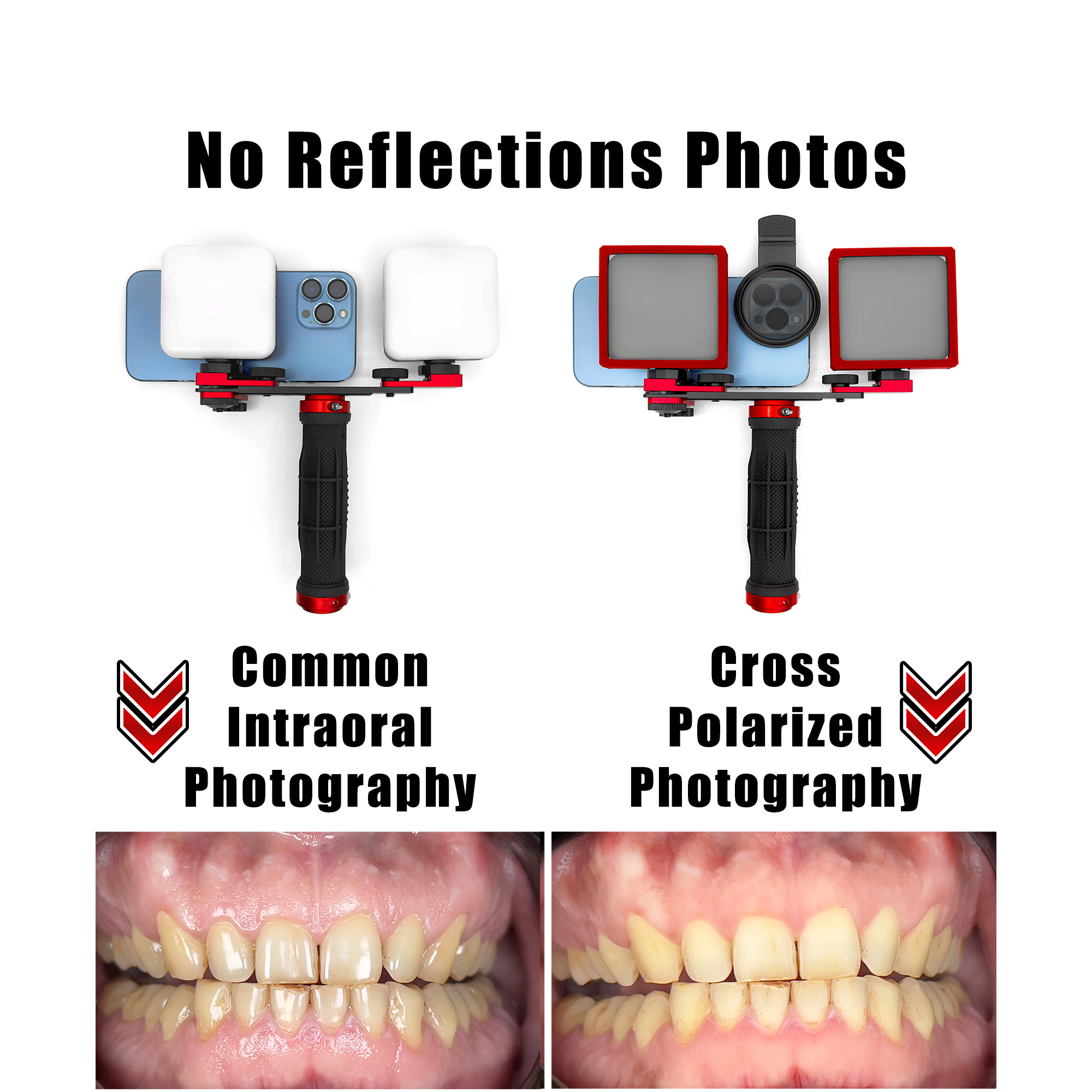 Dental Photography Kit, Mobile - Macro Photography Lighting Kit ulasan dan harga