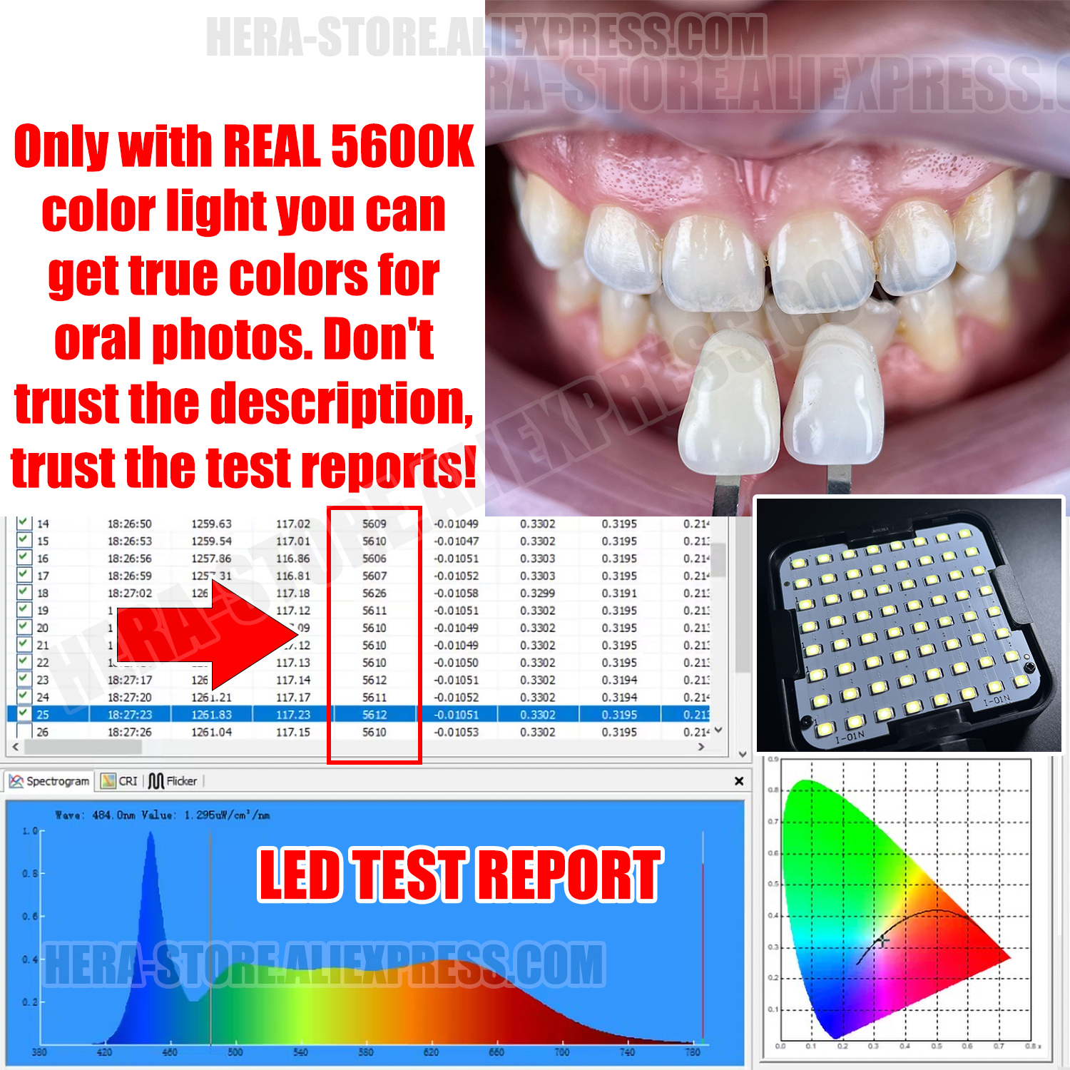 Dental Photography Kit, Mobile - Macro Photography Lighting Kit ulasan dan harga