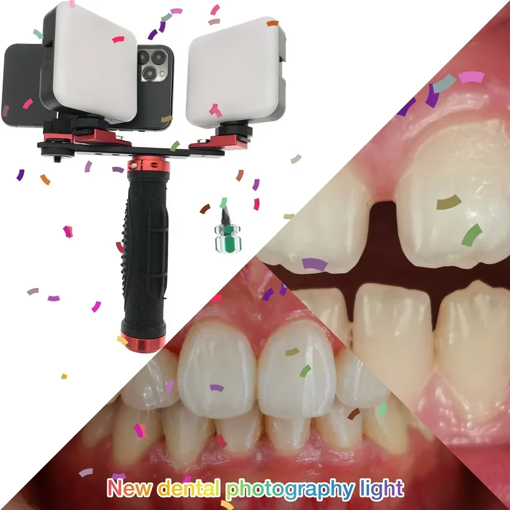 Mobile Phone Dentals Photograp - Photography Lighting Equipment ulasan dan harga
