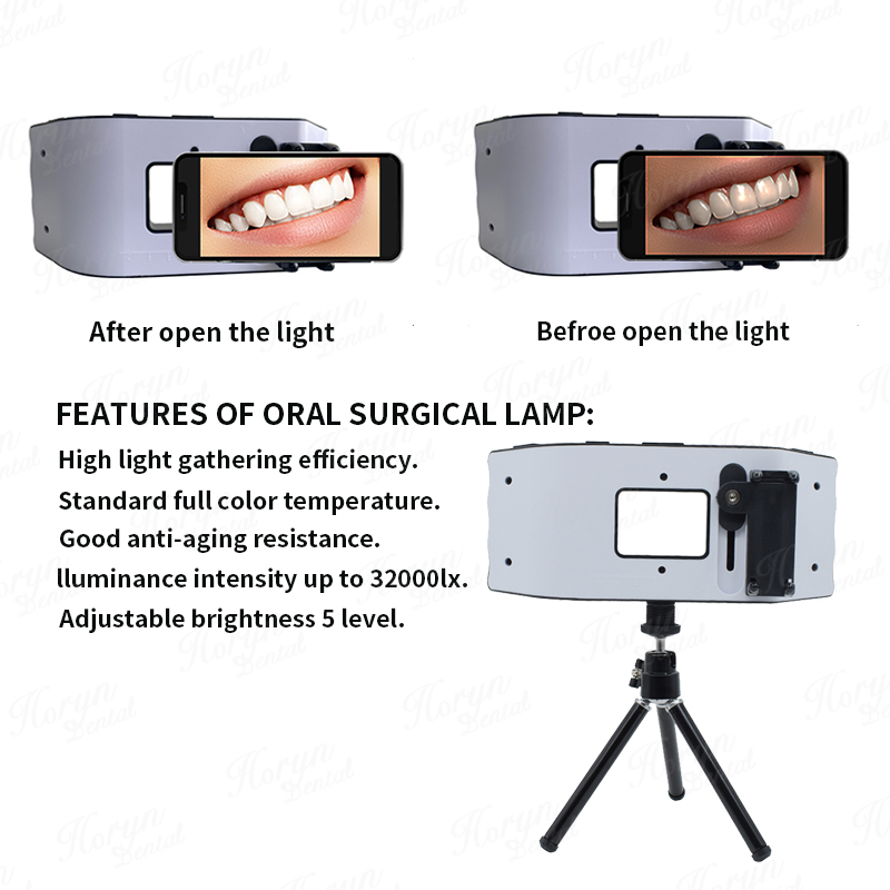 Dental Flash Light Photography - Photography Lighting With Flash ulasan dan harga